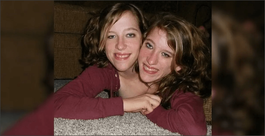 abby and brittany hensel