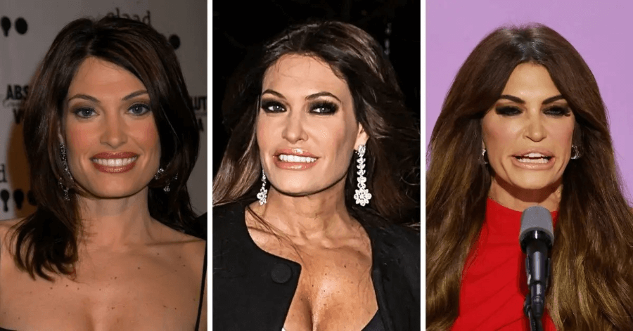 kimberly guilfoyle before and after