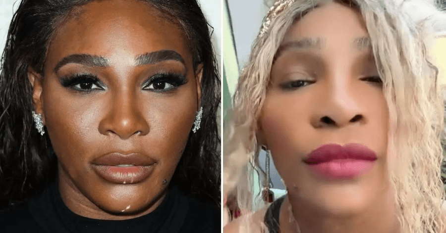 serena williams skin bleaching
