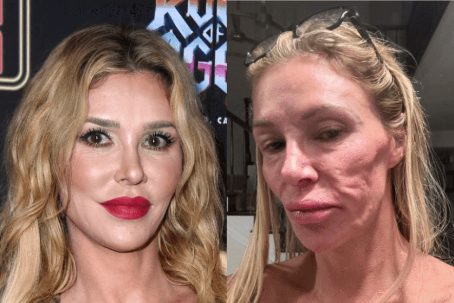 brandi glanville face
