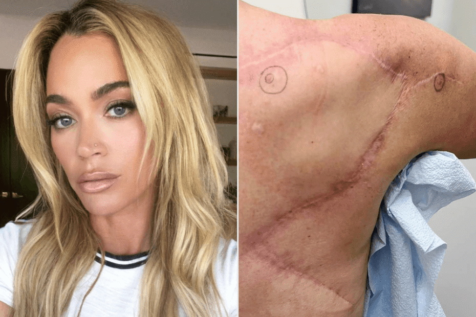 does teddi mellencamp have cancer