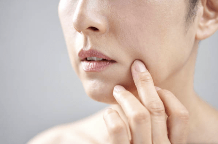 firmness skin meaning